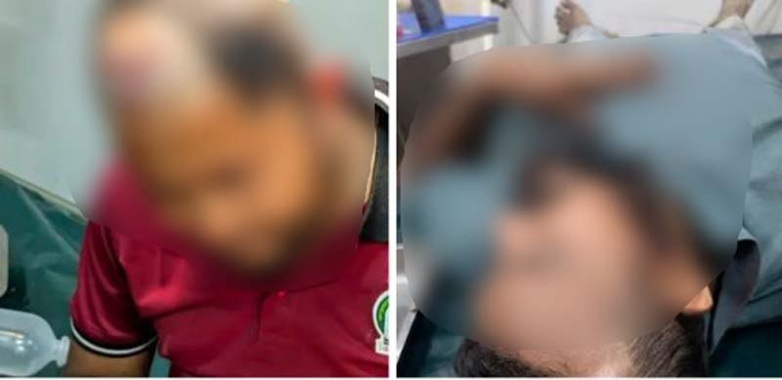 বনের জমি দখল করে পানবরজ, পানের ছড়া রেঞ্জ কর্মকর্তাসহ আহত ৫,