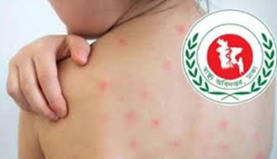 হাম ও হাম সন্দেহে শিশু মৃত্যু আড়াইশ ছাড়াল