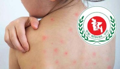 হাম সন্দেহে আরও ছয়জনের মৃত্যু