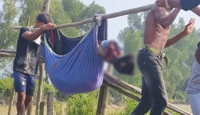 আরাকান আর্মির পুঁতে রাখা মাইন বিস্ফোরণে যুবকের পা বিচ্ছিন্ন